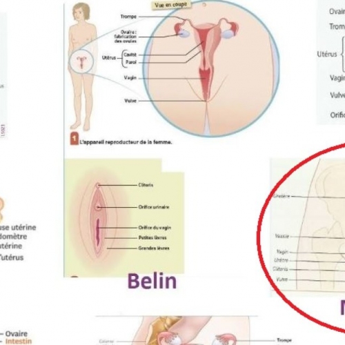 1 clitoris sur 8 !